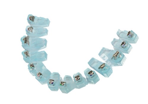 奥世美<span class='highlight'>数字化</span>正畸托槽实物示意图