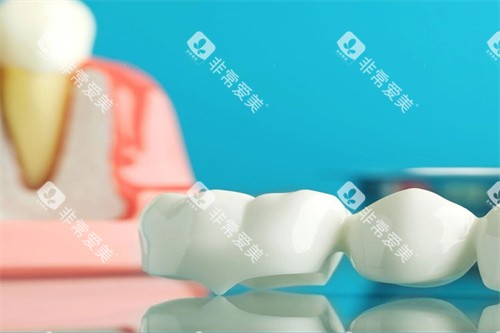 牙齿治疗材料图 牙齿治疗材料图