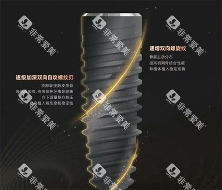 卡尔斯种植牙种植体螺纹照片
