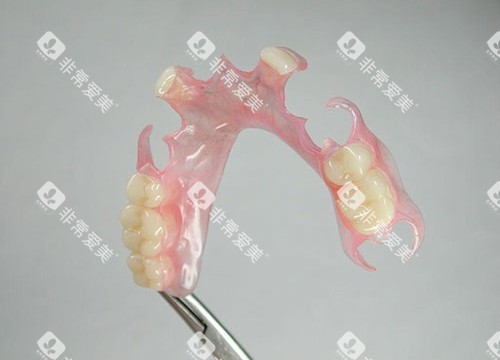 半口活动假牙展示