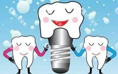 牙齿种植体示意图 牙齿种植体示意图