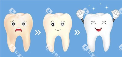 牙齿美白动画图 牙齿美白动画图