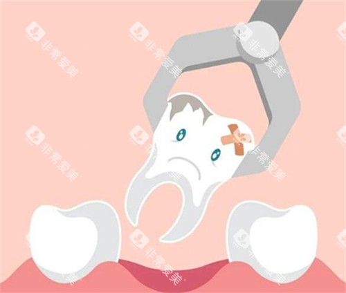牙齿拔除卡通图 牙齿拔除卡通图