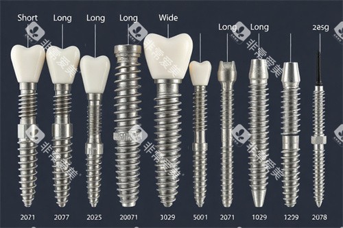 种植牙不同类型图 种植牙不同类型图