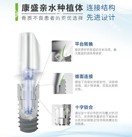康盛亲水种植牙