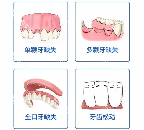 单颗多颗全口牙齿缺失及牙齿松动漫画图