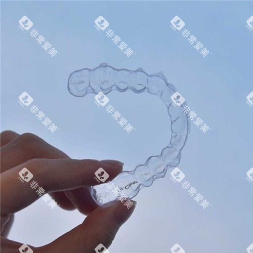 隐形牙套图展示 隐形牙套图展示