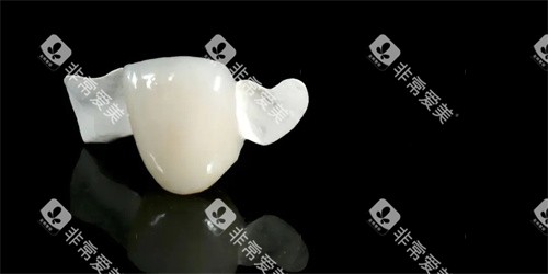 hpp粘接桥义齿单颗示意图