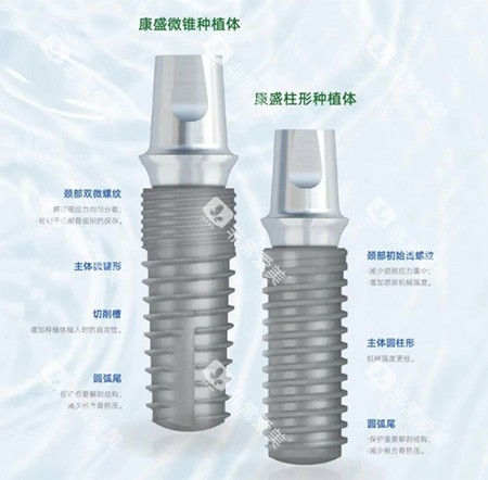 康盛微锥种植牙 康盛微锥种植牙