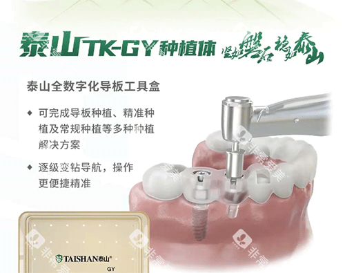 泰山种植牙怎么样 泰山种植牙怎么样