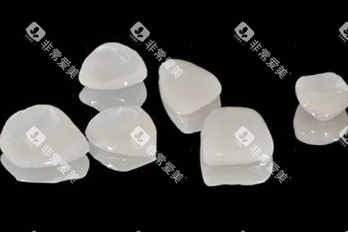 全瓷贴面实物展示图 全瓷贴面实物展示图