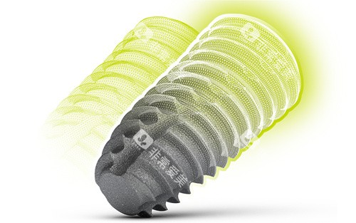 士卓曼种植牙图片 士卓曼种植牙图片