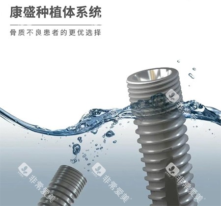 康盛种植牙怎么样 康盛种植牙怎么样