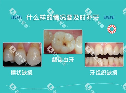 补牙适应症