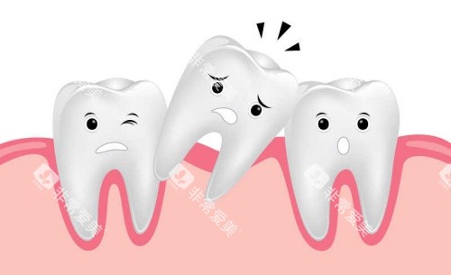 门牙歪斜漫画示意图 门牙歪斜漫画示意图