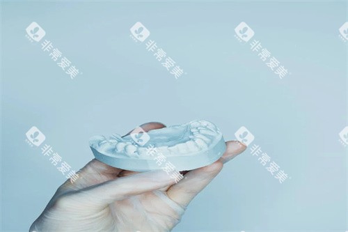 牙齿矫正模型展示