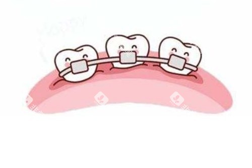 畸形牙齿矫正卡通图