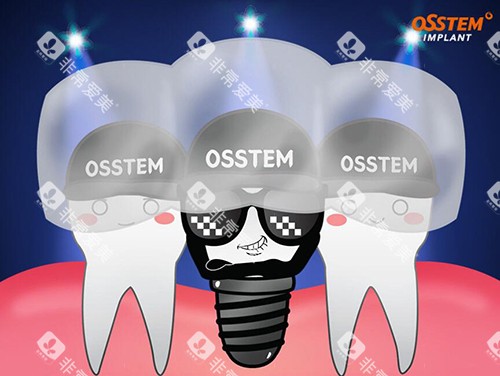 奥齿泰种植牙卡通图 奥齿泰种植牙卡通图