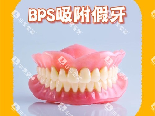 BPS吸附性义齿模型图