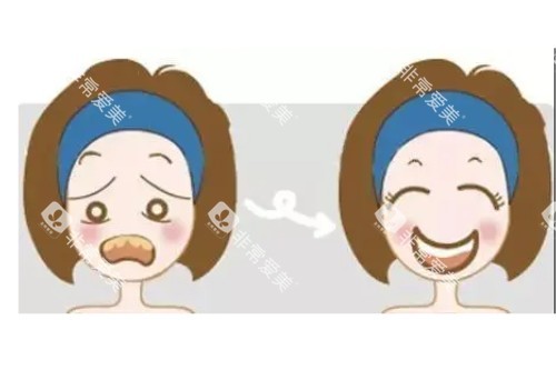 牙齿美白卡通图片一览