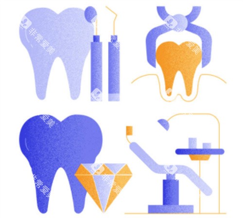 种植牙各个模型图 种植牙各个模型图