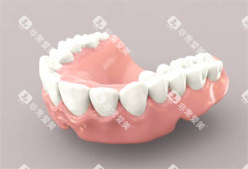 假牙模型图