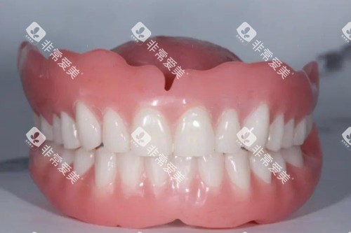 老年人假牙图片展示