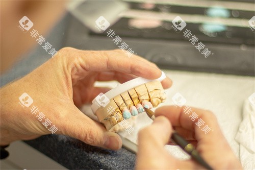 牙齿治疗操作图