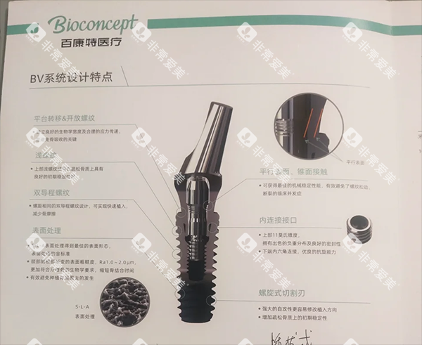 百康特种植牙好不好 百康特种植牙好不好