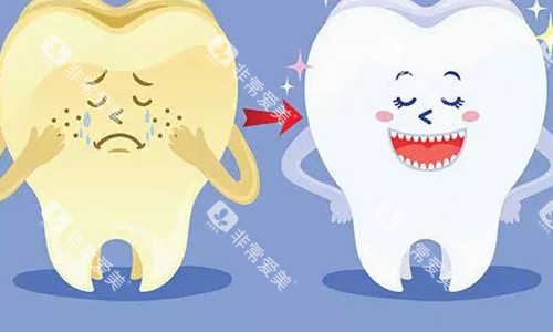 牙齿美白对比图