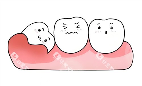 智齿卡通图片