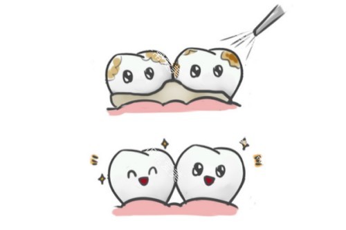 洗牙卡通图