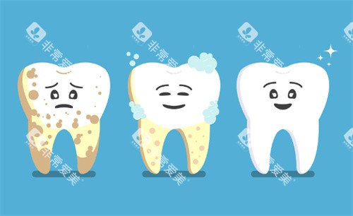 洗牙卡通