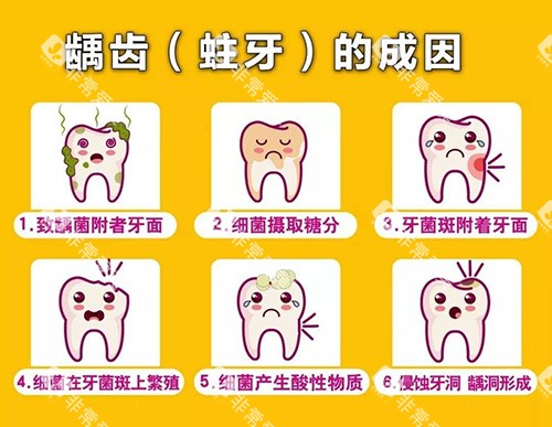 龋齿