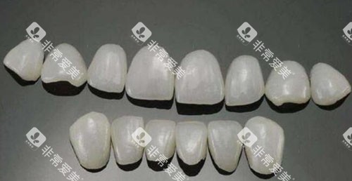 瓷贴面修复改善