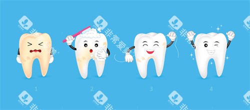 牙齿由黄变白4个阶段