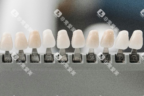 牙齿贴面色号 牙齿贴面色号