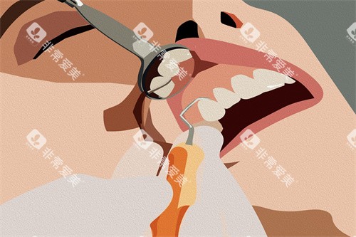 牙齿治疗卡通展示图