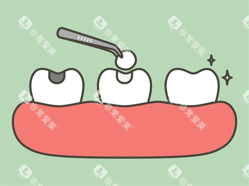 补牙漫画图示意图 补牙漫画图示意图