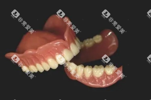 活动假牙图片展示 活动假牙图片展示