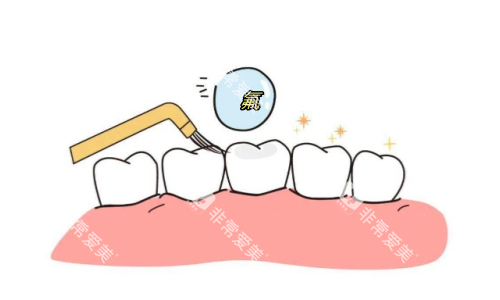 儿童牙齿涂氟动画展示图