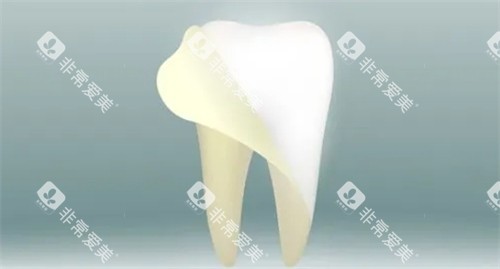 牙齿美白改善牙黄问题 牙齿美白改善牙黄问题