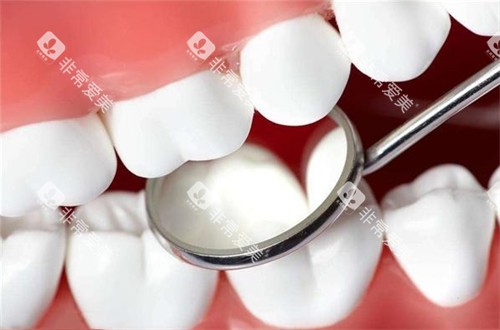 牙齿美白 牙齿美白