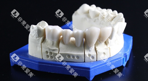 牙齿模型图 牙齿模型图