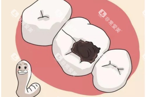 蛀牙卡通图片展示