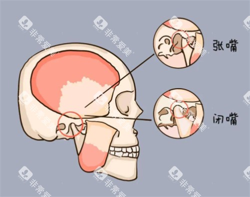 颞下颌关节紊乱会疼的位置 颞下颌关节紊乱会疼的位置