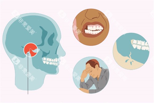 颞下颌关节紊乱引起的问题 颞下颌关节紊乱引起的问题
