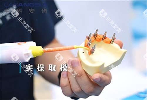 中科安齿种植牙实操取模