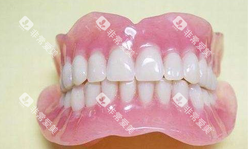 吸附性义齿照片 吸附性义齿照片