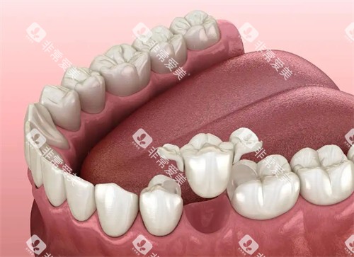 马里兰桥多少钱 马里兰桥多少钱